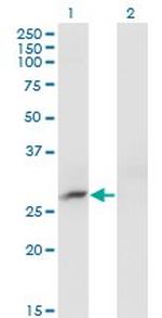 CRYBB3 Monoclonal Antibody (4H6)