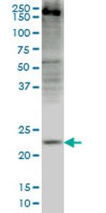 CRYGD Antibody in Western Blot (WB)