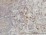 CSE1L Antibody in Immunohistochemistry (Paraffin) (IHC (P))