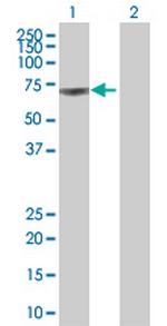 CSF1 Polyclonal Antibody, MaxPab™
