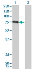 CSF1 Monoclonal Antibody (1A9)