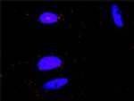 CSF1R Antibody in Proximity Ligation Assay (PLA) (PLA)