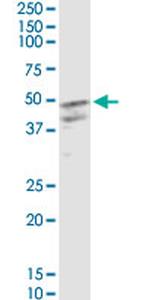 CSF2 Monoclonal Antibody (2G9)