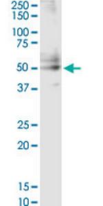 CSF2 Monoclonal Antibody (1D6)