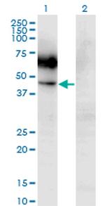 CSF2RA Monoclonal Antibody (2G5)
