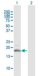 CSF3 Antibody in Western Blot (WB)