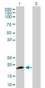CSF3 Antibody in Western Blot (WB)