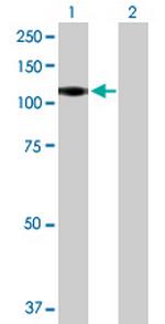 CSF3R Polyclonal Antibody, MaxPab™