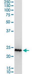 CSH1 Polyclonal Antibody, MaxPab™
