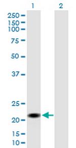 CSH2 Antibody in Western Blot (WB)