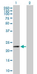 CSN3 Polyclonal Antibody, MaxPab™