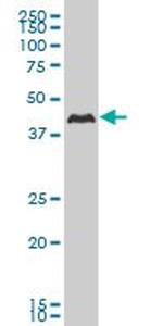 CSNK1G2 Antibody in Western Blot (WB)