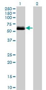 CSNK1G2 Monoclonal Antibody (2F5)