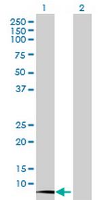 CST3 Antibody in Western Blot (WB)