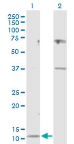 CST3 Antibody in Western Blot (WB)