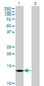CST6 Polyclonal Antibody, MaxPab™