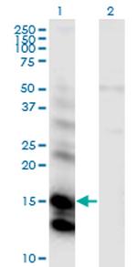 CST6 Monoclonal Antibody (2H8)