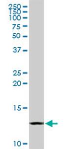 CSTB Antibody in Western Blot (WB)