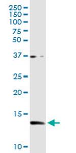CSTB Antibody in Western Blot (WB)