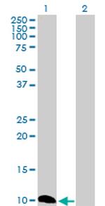 CSTB Polyclonal Antibody, MaxPab™