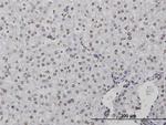 CSTB Monoclonal Antibody (M1-C1)