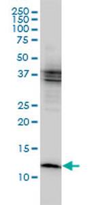 CSTB Antibody in Western Blot (WB)