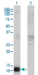 CSTB Antibody in Western Blot (WB)
