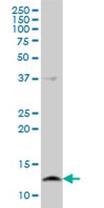 CSTB Antibody in Western Blot (WB)