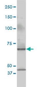 CSTF2 Antibody in Western Blot (WB)