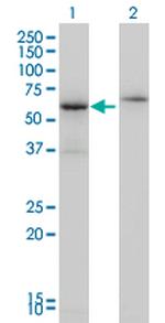 CSTF2 Antibody in Western Blot (WB)