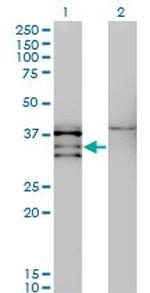 NKX2-5 Antibody in Western Blot (WB)