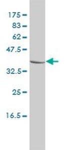 CTBS Monoclonal Antibody (1B5-1B9)