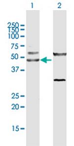 CTBP1 Polyclonal Antibody, MaxPab™