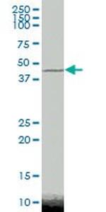 CTBP2 Antibody in Western Blot (WB)