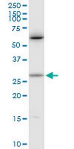CTF1 Polyclonal Antibody, MaxPab™