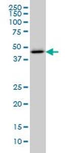 CTH Monoclonal Antibody (2E12-1C10)