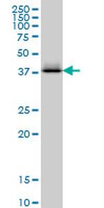 CTH Antibody in Western Blot (WB)