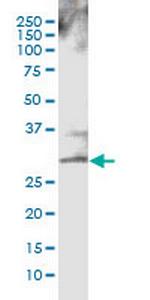 CTLA4 Monoclonal Antibody (8D7)