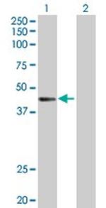 CTNS Polyclonal Antibody, MaxPab™