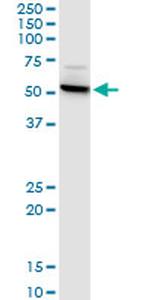 CTNS Monoclonal Antibody (5G6)