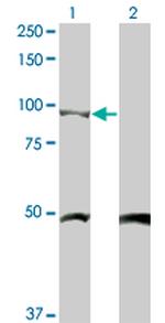 CTNNB1 Antibody in Western Blot (WB)