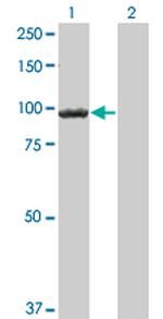 CTNNB1 Antibody in Western Blot (WB)