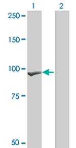 CTNNB1 Antibody in Western Blot (WB)