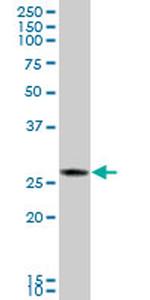 CTRB1 Antibody in Western Blot (WB)
