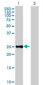 CTRB1 Polyclonal Antibody, MaxPab™
