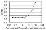 CTRB1 Antibody in ELISA (ELISA)