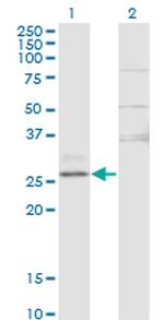 CTRB1 Antibody in Western Blot (WB)