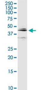 CTSD Antibody in Western Blot (WB)