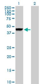 CTSD Polyclonal Antibody, MaxPab™