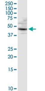 CTSD Antibody in Western Blot (WB)
